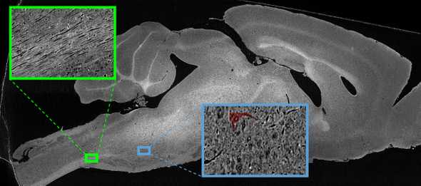 cells and axons