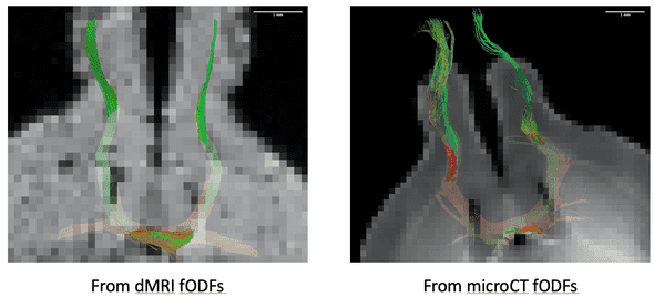 Tractography